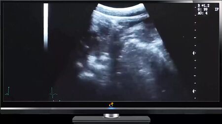 Papà: Scopata profonda con ecografia