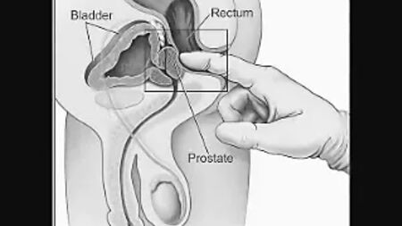 Come massaggiare la prostata da soli